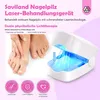 Nagelpilz Lampe LED Nagelpflegegerät, UV Phototherapie, Produktbild-Vorschau 6