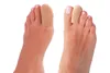 Finger-& Zehenschutz Set Soft 6-teilig Produktbild-Vorschau 2