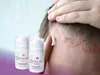 Dermione® - Trattamento enzimatico delicato per la pelle, Anteprima dell’immagine prodotto 1