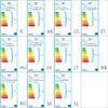 EGLO MELGOA, Zarovnané, 1 žárovek, E27, IP44, Černá Náhled obrázku produktu 6