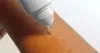 Saalux Odstraňovač lupín s aplikátorom s mäkkou špičkou (75 Náhľad obrázku produktu 3