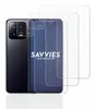 6x Für Xiaomi 13 (Display+Kamera) Schutzfolie Savvies Produktbild-Vorschau 2