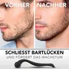 Anthony Brown Bartroller 0,5 mm, Set mit Reinigungsspray Produktbild-Vorschau 4