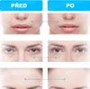 Přístroj pro terapii Mikroproudem, proti vráskám, svalová Náhled obrázku produktu 10
