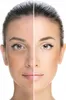 Darsonval Derma Wand Pro Gesichtspflegegerät 4 Elektroden Produktbild-Vorschau 9