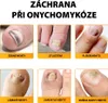 Náplasti na nehtovou mykózu 32 ks Náhled obrázku produktu 4