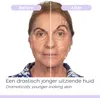 Derma Wand - DermaWand PRO - Hautpflege Produktbild-Vorschau 5