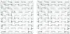 Nachtmann Bossa Nova Platte Quadratisch, 2er Set, Produktbild-Vorschau 4