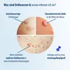 Diagram explaining what molluscum contagiosum (Dellwarzen) are and how to recognize them. Náhľad obrázku produktu