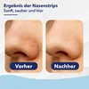 Paremmin Mitesser Entferner Strips mit Aktivkohle für die Produktbild-Vorschau 3