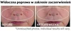 StriVectin Advanced Retinol Multi-Correct Serum na noc 30 Podgląd zdjęcia produktu 8