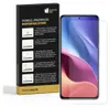 3x Panzerfolie für Xiaomi 11T FULL COVER HYDROGEL Produktbild-Vorschau 2