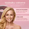 LIROMA® LED pleťová maska – světelná terapie obličeje 7 Náhled obrázku produktu 5