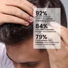 RevitalTrax - Anti-Haarausfall-Shampoo mit Aloe Vera - Für Produktbild-Vorschau 3