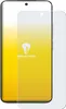 upscreen Schutzfolie für Xiaomi 15 Displayschutz Produktbild-Vorschau 2
