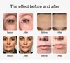 Prístroj na vodný peeling tváre – 10 v 1: H2O2 Náhľad obrázku produktu 7