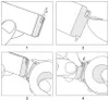 20mm Armband für Samsung Galaxy Watch 7 6 5 4 40mm 44mm, Produktbild-Vorschau 2
