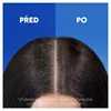 Head & Shoulders Repair & Care Szampon, 400 ml Anteprima dell’immagine prodotto 8