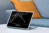 MuchoWow® Laptop Aufkleber Sticker Cover Stadtplan - Produktbild-Vorschau 4