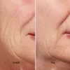Silk'n Silk'n Skincare Appareil de soin du visage - Voir les images du produit 7