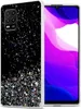Cadorabo Hülle für Xiaomi Mi 10 LITE in Schwarz mit Glitter Produktbild-Vorschau 1