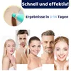 Paremmin 2-in-1 Stielwarzen Entfernen Kit (40 Stück) – Für Produktbild-Vorschau 10