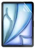 A tablet screen protector with a blue and white abstract design. Produktbild-Vorschau