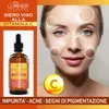 LUMINER Siero Vitamina C 100ml, Siero Viso Acido Anteprima dell’immagine prodotto 7