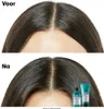 Loreal Serie Expert Scalp Advanced Anti-Discomfort Voir les images du produit 4