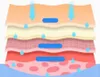 Wasserstoffreinigung, Wasserstoffpeeling - Wasserstoff Produktbild-Vorschau 5