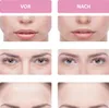 Kosmetisches Gerät Faltenentferner Gesichtsmassagegerät mit Produktbild-Vorschau 7