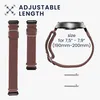 kwmobile Armband kompatibel mit Xiaomi Redmi Watch 3 Active Produktbild-Vorschau 5