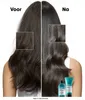 L´Oréal Professionnel Scalp Advanced Anti-Discomfort Náhľad obrázku produktu 5