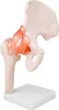 Anatomický model Anatomický model kostry bedrového kĺbu Náhľad obrázku produktu 1