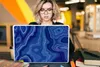 MuchoWow® Laptop Aufkleber Sticker Cover Blau - Achat - Produktbild-Vorschau 5