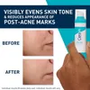 Sérum Gesichtsbehandlung CeraVe Resurfacing Retinol (30 ml) Produktbild-Vorschau 4