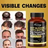 DHT Blocker with Biotin, Saw Palmetto, Beta-Sitosterol (120 Produktbild-Vorschau 6