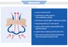 Náplasti proti chrápání NASAL STRIP 30 ks Náhled obrázku produktu 4