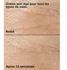 Clinique Smart Clinical Repair, para mujeres, 50 ml, crema, Vista previa de la imagen del producto 10