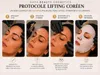 Kollagen-Seidenfaden-Set mit Goldserum, 36 Fäden Productafbeelding-voorbeeld