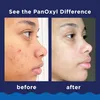 PanOxyl Acne Foaming Wash Benzoyl Peroxide 10% Maximum Produktbild-Vorschau 2