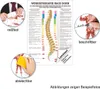 Wirbeltherapie nach Dorn Poster Anatomie 70x50 cm Produktbild-Vorschau 3