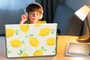 MuchoWow® Laptop Aufkleber Sticker Cover Zitrone - Obst - Produktbild-Vorschau 3