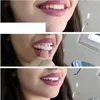 Licówki dentystyczne Snap on Smile 1 sztuka (zestaw góra i Podgląd zdjęcia produktu 6