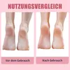 Before and after comparison of feet, showing improved skin texture. Produktbild-Vorschau