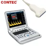 Échographe portable avec sonde linéaire Doppler couleur Voir les images du produit 1