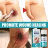 10 ml tekutý obväz, vodotesný, priehľadný, prenosný, Náhľad obrázku produktu 2