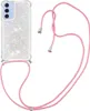 Samsung Galaxy A17 Hülle - Coverup Liquid Glitzer Back Produktbild-Vorschau 1