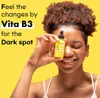 TIAM - Vita B3 Source - Sérum proti hyperpigmentaci pleti - Náhled obrázku produktu 7