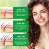 Rosmarinöl Ätherisches Öl 30ml Haarwachstum Kopfhaut Produktbild-Vorschau 3